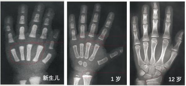 我家寶寶不長個怎麼辦?這幾類檢查瞭解一下 我家寶寶不長個怎麼辦?這幾類檢查瞭解一下