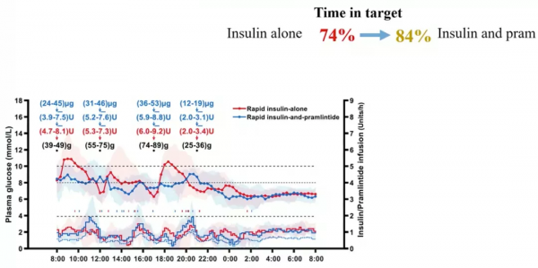 人工胰腺技術更趨成熟!用於T1DM的速效胰島素與普蘭林肽閉環系統 人工胰腺技術更趨成熟!用於T1DM的速效胰島素與普蘭林肽閉環系統
