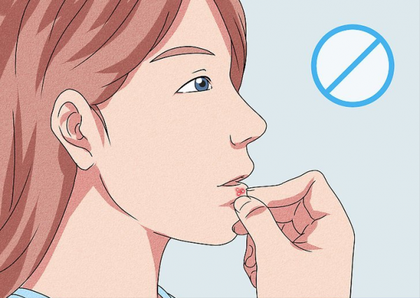 如何治癒唇皰疹外殼