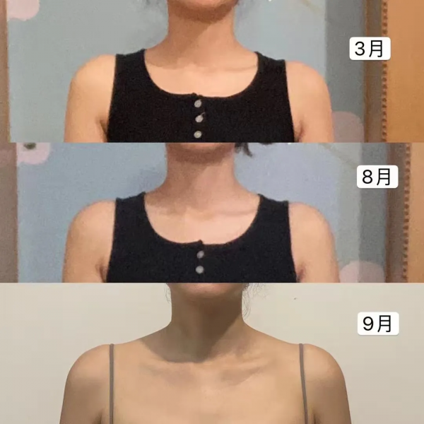 不練直角肩，反而擁有了直角肩