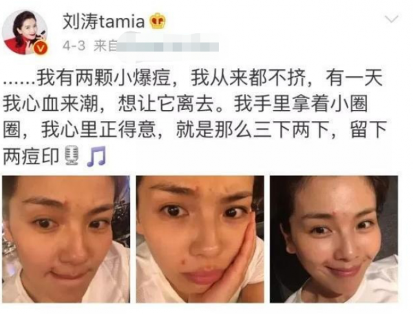 37歲白百何曬懟臉自拍！素顏出鏡面色紅潤，下巴一顆痘痘好顯眼