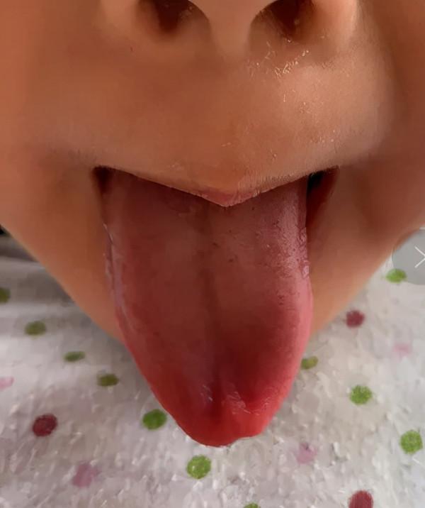 小兒體溫居高不下,可能是食積作祟,中醫消食導滯法,療效顯著 小兒體溫居高不下,可能是食積作祟,中醫消食導滯法,療效顯著