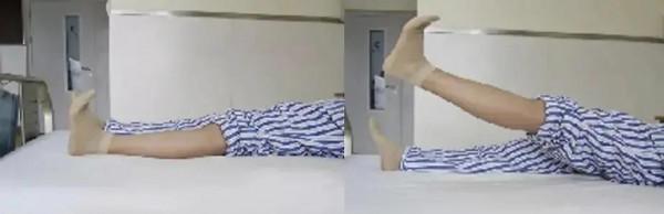 膝關節術後股四頭肌康復訓練