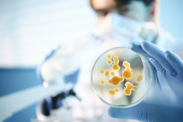 食物亂放冰箱裡，當心中毒