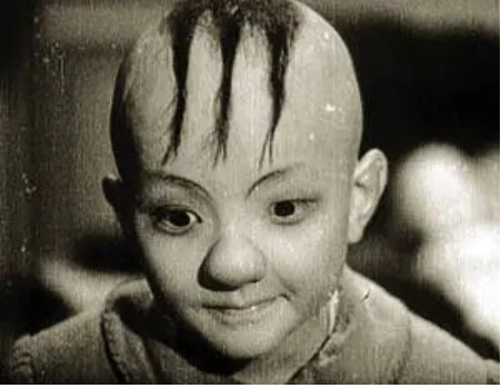 “三毛”長大了!8歲成名,14歲禿頂,34歲變帥哥,植髮挨300多針 “三毛”長大了!8歲成名,14歲禿頂,34歲變帥哥,植髮挨300多針