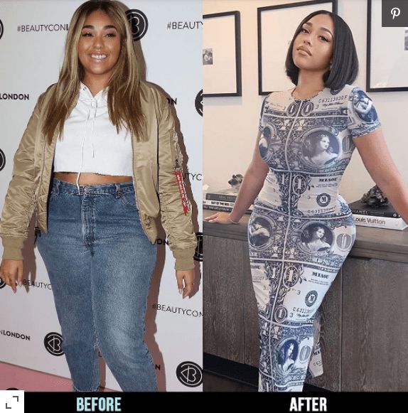 唐斯女友身穿鑽石裙子,高調炫富,遭網友吐槽整容過度 唐斯女友身穿鑽石裙子,高調炫富,遭網友吐槽整容過度