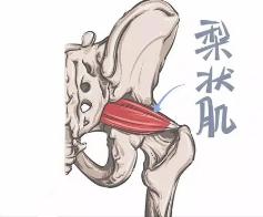 腰疼腿麻可不一定是腰脫，也許是這塊肌肉出問題？