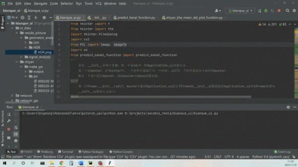 國際首創智慧讀片！1秒內自動測算5個腰椎間盤20個參量，精準判斷退變分級
