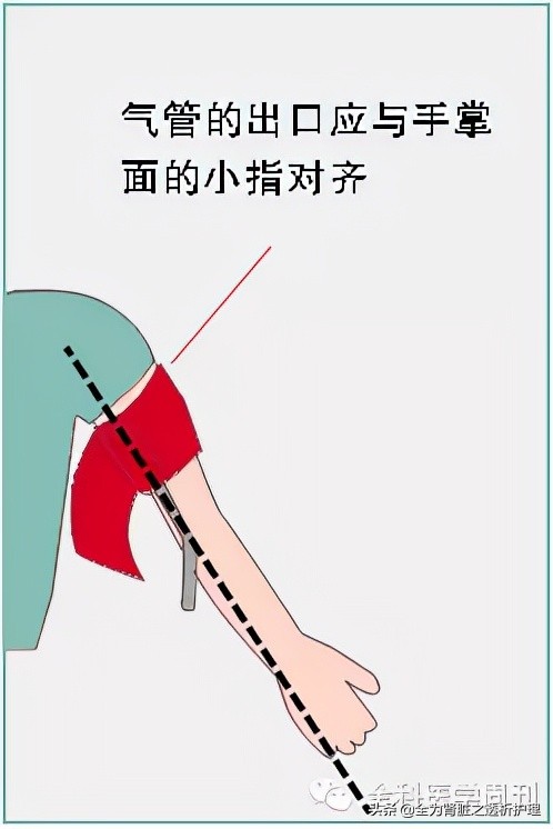 全國高血壓日 | 你認真測血壓了嗎？