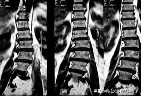 背痛：16 個背痛的真相和神話
