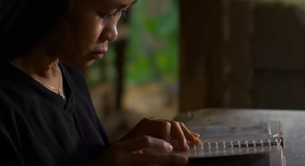 16歲菲律賓少女迅速衰老成60歲老人的臉,尋遍醫生後找出心酸病因 16歲菲律賓少女迅速衰老成60歲老人的臉,尋遍醫生後找出心酸病因