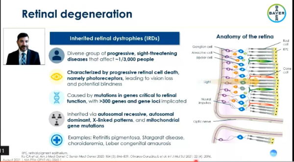 探索視網膜醫療的地平線：EURETINA中的視網膜疾病新篇章