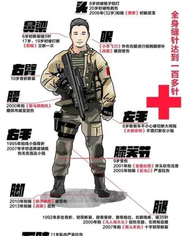 明星受傷時的反應：吳京霸氣、成龍淡定，蔡徐坤呢？