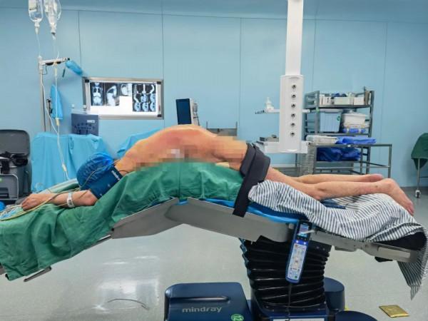 【醫療動態】甘肅省中醫院脊柱微創骨科團隊為重度脊柱後凸畸形患者重啟 “挺脊人生”