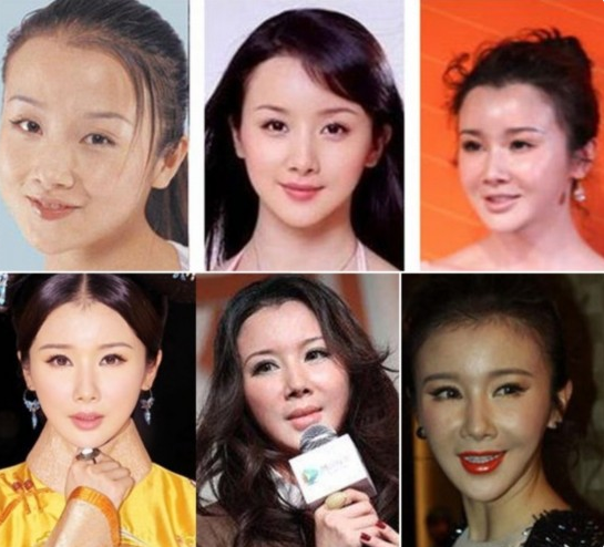 臉部凹陷如鬼，脖子青筋暴起，這些暴瘦的女星自己不害怕嗎？