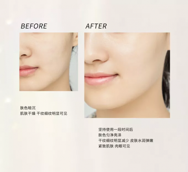 不動刀不打針!這幾個單品讓你體驗貴婦級抗衰 不動刀不打針!這幾個單品讓你體驗貴婦級抗衰