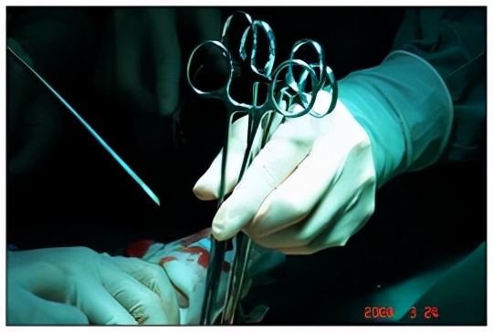 乳腺癌手術，該怎樣正確選擇？醫生告訴你