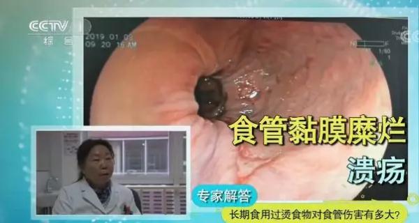 千萬別拿養病當養生,毀掉你健康的正是這些“好習慣” 千萬別拿養病當養生,毀掉你健康的正是這些“好習慣”