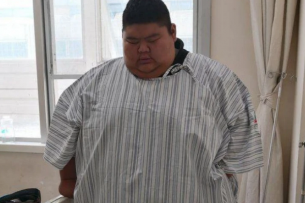 “山東第一胖”重668斤,為愛一年減重400斤,如今愛情事業雙豐收 “山東第一胖”重668斤,為愛一年減重400斤,如今愛情事業雙豐收