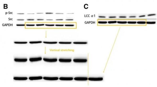 中山大學附屬醫院聯合發表的論文被質疑蛋白條帶處理後重復使用