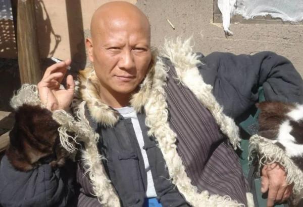 可憐的計春華，18歲鋁中毒後，他的犧牲遠比你想得更大