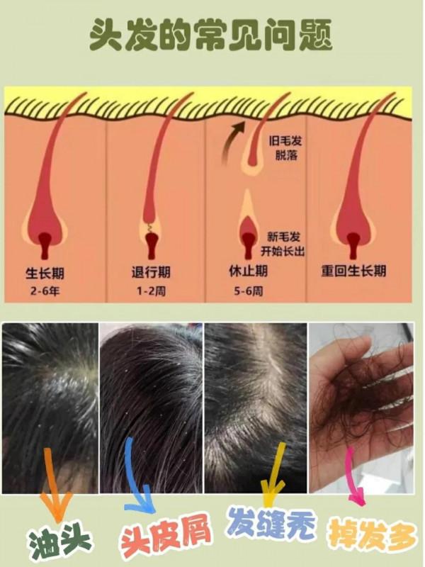 只要找對方法，養好頭髮那還不簡單