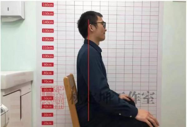 醫林正骨丨脖頸痠痛想要緩解，別靠“仰”,要靠“養”