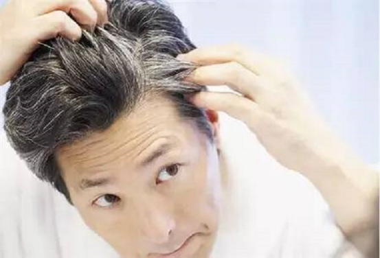 為何白頭髮會越長越多?不要覺得自己老了,或許是缺少這3種營養 為何白頭髮會越長越多?不要覺得自己老了,或許是缺少這3種營養