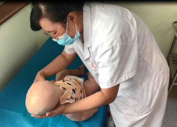 8個月依舊豎頭不穩,醫生李樹珍為發育遲緩寶寶帶來康復之光 8個月依舊豎頭不穩,醫生李樹珍為發育遲緩寶寶帶來康復之光