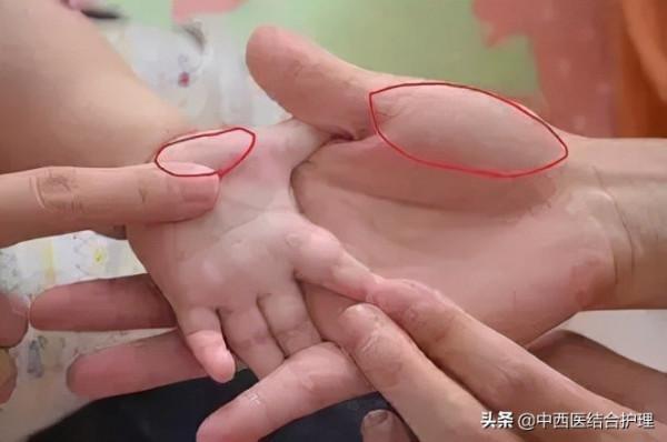 「中醫養生」火在肺裡:咳嗽;火在肝裡:失眠;火在胃裡:口臭;火在心裡:口舌生瘡 「中醫養生」火在肺裡:咳嗽;火在肝裡:失眠;火在胃裡:口臭;火在心裡:口舌生瘡