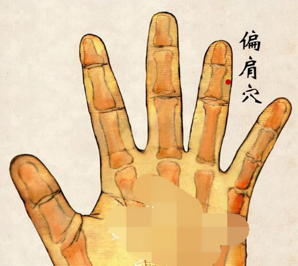 中醫針灸肩部疾病處方1 中醫針灸肩部疾病處方1