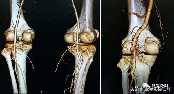 CT斷層解剖圖譜最全總結「推薦收藏」 CT斷層解剖圖譜最全總結「推薦收藏」
