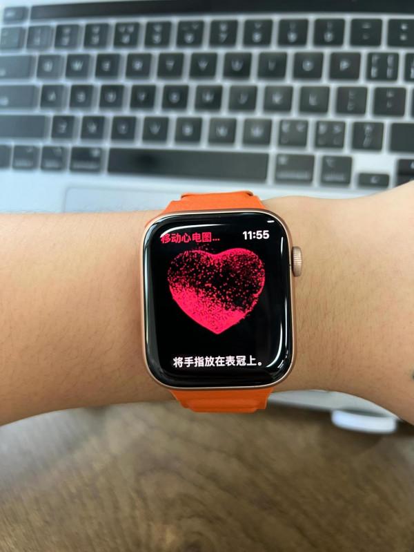 Apple Watch 心電圖（ ECG ）功能終於來啦