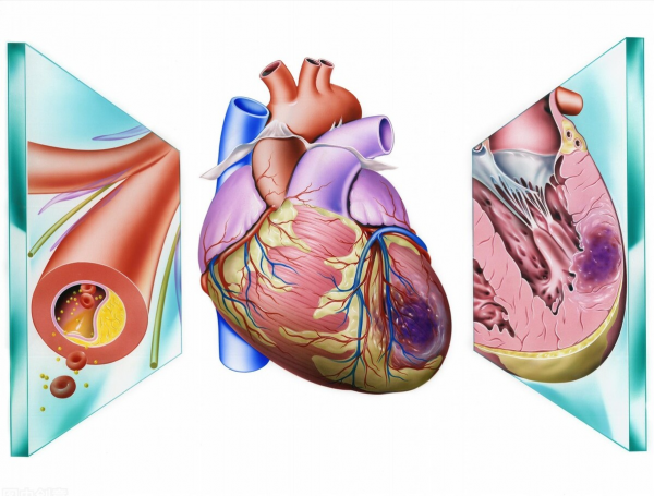 2箇中成藥，降脂化濁、抑制斑塊生成、打通血脈，抗冠心病和腦梗