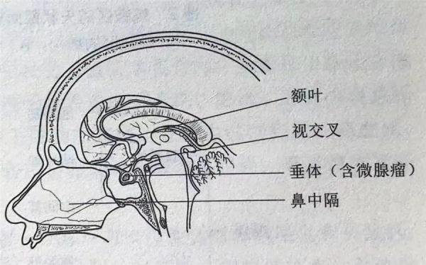 已經29歲!福州女子卻在長高變醜 已經29歲!福州女子卻在長高變醜