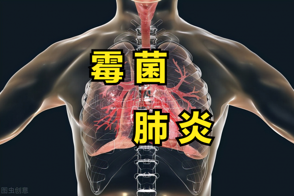 可怕,女子收玉米得肺炎,肺部長滿黴菌,注意家中這些位置易發黴 可怕,女子收玉米得肺炎,肺部長滿黴菌,注意家中這些位置易發黴