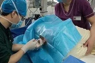 聊聊剖腹產那些事兒（一）