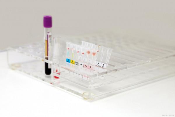 吃素＝血脂正常？別被忽悠了，3個“坑”要注意避免