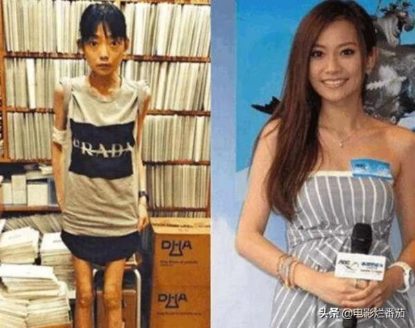 “內卷”下暴瘦的娛樂圈明星，有的瘦到74斤，有的體力不支坐輪椅