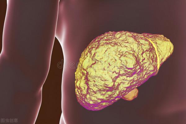 肝硬化與喝酒有關？除了喝酒，還有這5大高危因素不可不防