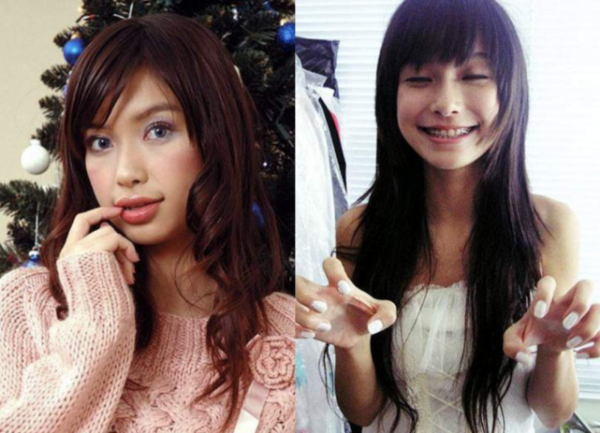 傅園慧整牙後&OpenCurlyDoubleQuote;洪荒少女&rdquo;變&OpenCurlyDoubleQuote;仙女&rdquo;，網友表示錯怪baby了