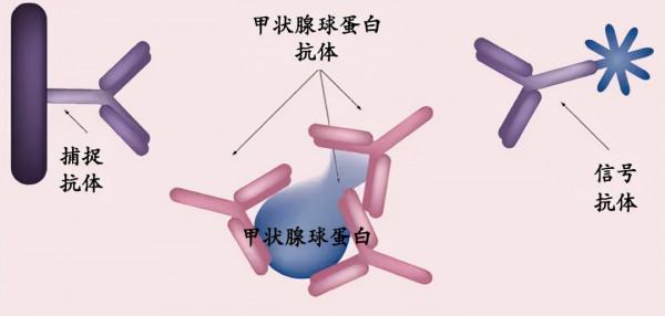 甲狀腺癌術後最重要的指標