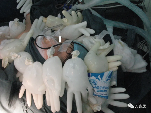 惡性高熱第1例:2007年西京醫院術中“惡性高熱”一例 惡性高熱第1例:2007年西京醫院術中“惡性高熱”一例