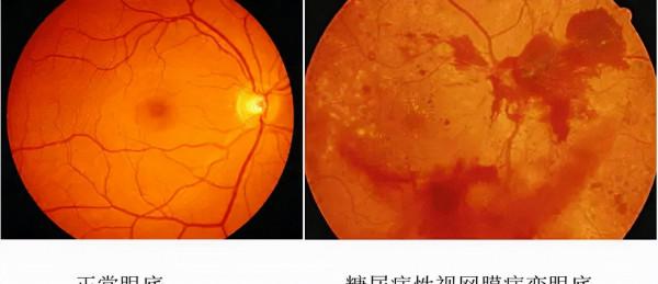 糖友們,收下這份“月餅食用指南”,讓“糖網”離你遠一點 糖友們,收下這份“月餅食用指南”,讓“糖網”離你遠一點