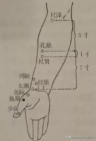 肩周炎，肩袖損傷，肩膀痛，快試試針灸吧
