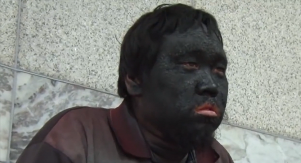 帶著妹妹流浪10年，每天用鞋油抹臉，覺得只要這樣就不會被欺負