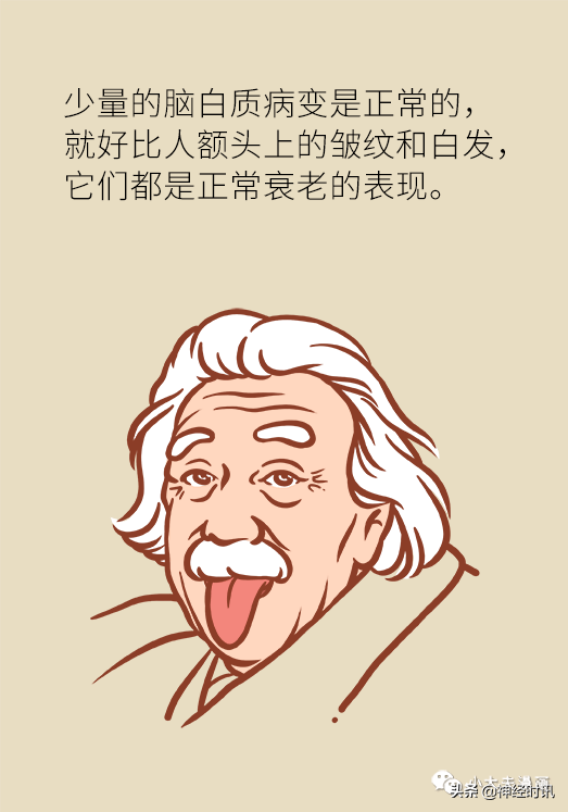 “腔隙性腦梗”到底怎麼回事？這篇文章全說透了