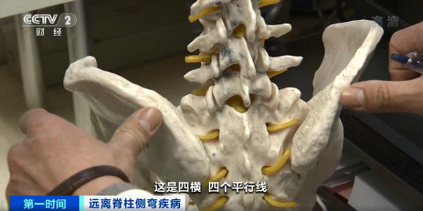 伏案時間過久，頸椎不舒服？預防脊柱側彎，不妨用毛巾做2個動作