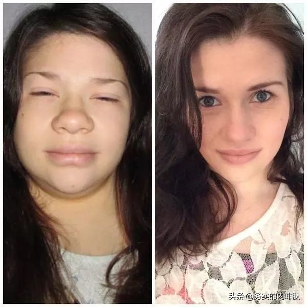 臨床基本功:一眼診病 臨床基本功:一眼診病