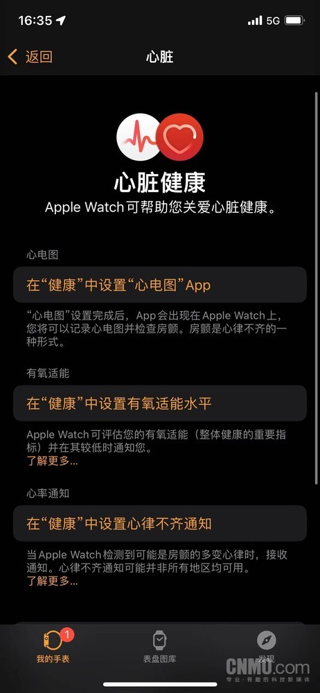 你的國行Apple Watch可以開通ECG了嗎?我開了 你試試 你的國行Apple Watch可以開通ECG了嗎?我開了 你試試
